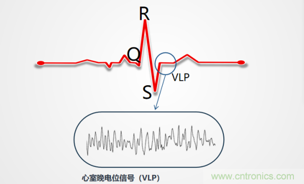 解決心電監(jiān)測(cè)行業(yè)難題，曼森伯格的濾波技術(shù)獲國(guó)家知識(shí)產(chǎn)權(quán)局發(fā)明授權(quán)